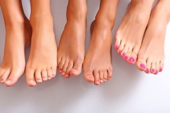 Las causas de la aparición del hongo en las uñas